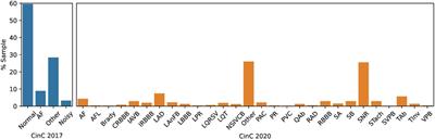 Machine learning-based detection of cardiovascular disease using ECG signals: performance vs. complexity